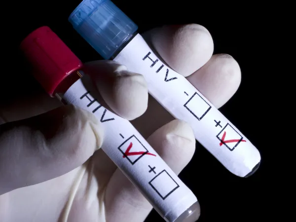 hiv