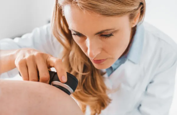 Dermatolog Ljubljana: 7 kožnih sprememb, ki jih ni dobro predolgo opazovati doma