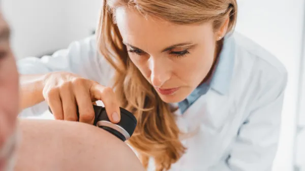 Dermatolog Ljubljana: 7 kožnih sprememb, ki jih ni dobro predolgo opazovati doma